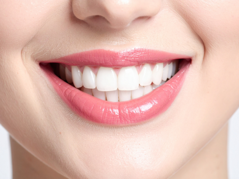 Cosmetic dentist performing dental bonding at Princeview Dental Etobicoke