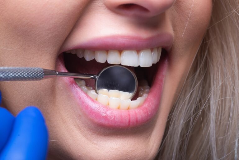 Biomimetic Dentistry Ontario: A More Conservative Approach to Modern Fillings