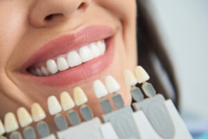 Teeth Whitening in Etobicoke: Subtle Enhancements Before Summer Events Begin